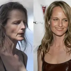 Helen Hunt operacje plastyczne - szokująca prawda o metamorfozie gwiazdy